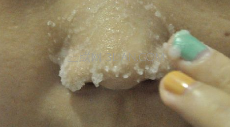 怎样缩小毛孔去黑头 114