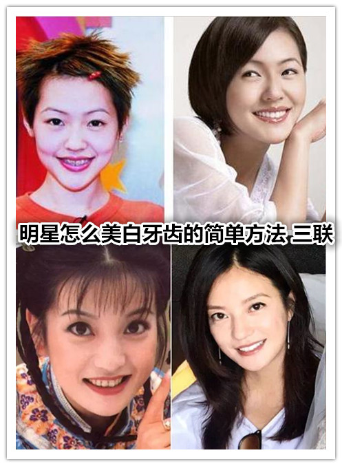 明星怎么美白牙齿的简单方法 114.jpg