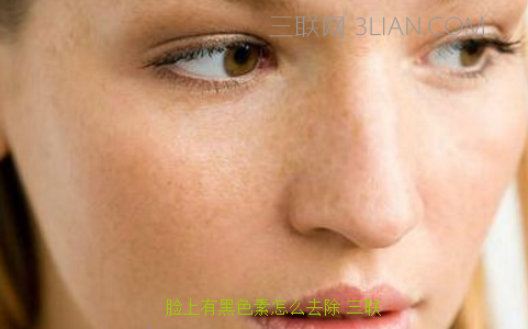 脸上有黑色素怎么去除 114
