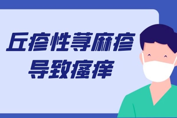 瘙痒 瘙痒