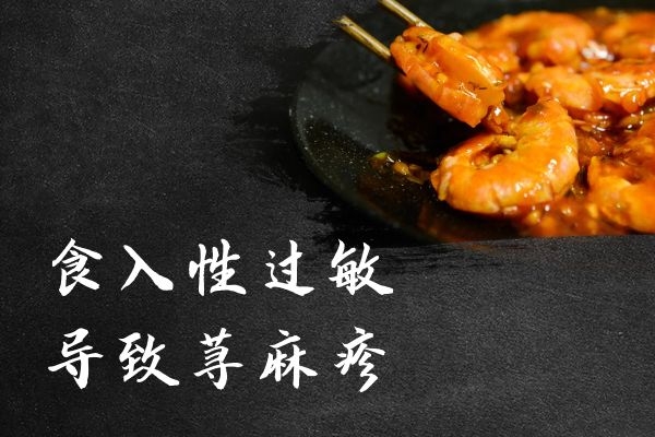 食入性过敏 食入性过敏